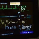 British Heart Foundation said the number of people with a heart rhythm condition has passed 1.5 million.