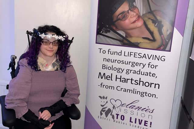 Melanie Hartshorn has walked for the first time after undergoing surgery.