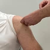 Beds, Luton and Milton Keynes have received the lowest number of Covid-19 vaccines in the East of England region, despite having some of the worst affected towns
