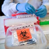 The rate of infection in Central Bedfordshire now stands at 5,551 cases per 100,000 people, lower than the England average