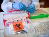 The rate of infection in Central Bedfordshire now stands at 5,551 cases per 100,000 people, lower than the England average
