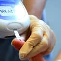 A nurse giving a patient a diabetes test