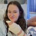 Crystal (left) and her left index finger just before her surgery.