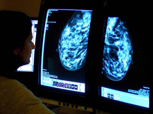 File photo of a consultant analysing a mammogram of a woman's breast in order check for breast cancer.