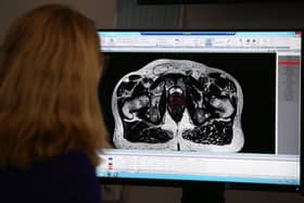 Dr Alison Tree, Consultant Clinical Oncologist at The Royal Marsden, treats patient diagnosed with prostate cancer