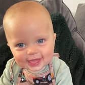 Little Daniel Donegan suffers from a condition known as Plagiocephaly (flat head syndrome)