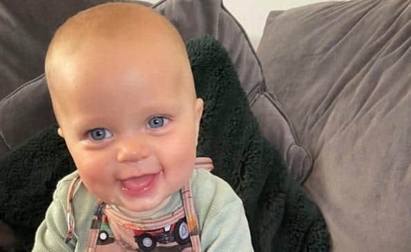 Little Daniel Donegan suffers from a condition known as Plagiocephaly (flat head syndrome)