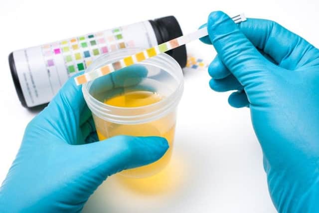 Simple urine test could measure how long we have left to live